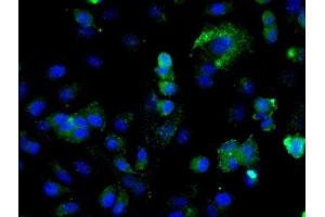 Immunofluorescence (Cultured Cells) (IF (cc)) image for anti-Integrin-Linked Kinase (ILK) (AA 301-400) antibody (ABIN727800)