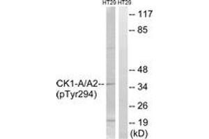 Western blot analysis of extracts from HT29 cells treated with heat shock, using CK-1 alpha (Phospho-Tyr294) Antibody. (CSNK1A1 Antikörper  (pTyr294))