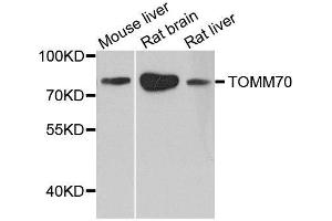 Western blot analysis of extracts of various cell lines, using TOMM70 antibody. (TOM70 Antikörper  (AA 60-340))