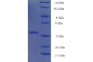 SDS-PAGE (SDS) image for Yippee-Like 1 (YPEL1) (AA 1-119), (full length) protein (His-SUMO Tag) (ABIN5710638)