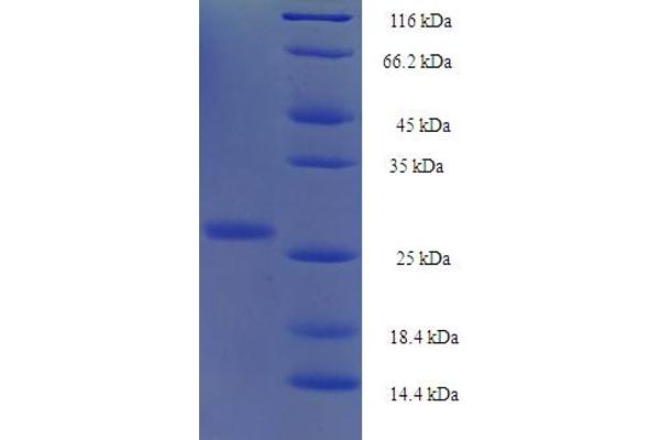 YPEL1 Protein (AA 1-119, full length) (His-SUMO Tag)