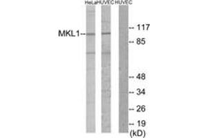 Western blot analysis of extracts from HuvEc/HeLa cells, using MKL1 Antibody.
