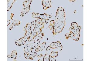 IHC analysis of LSM8 using anti-LSM8 antibody (ABIN7599578). (NAA38 Antikörper  (AA 1-96))