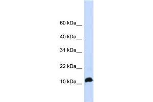 WB Suggested Anti-NHLH1 Antibody Titration: 0. (NHLH1 Antikörper  (Middle Region))