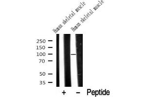 Western blot analysis of extracts of Human skeletal muscle? (Dystroglycan Antikörper  (C-Term))