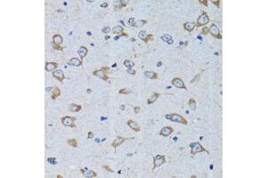Immunohistochemistry of paraffin-embedded rat brain using RARS antibody (ABIN5973728) at dilution of 1/100 (40x lens). (RARS Antikörper)