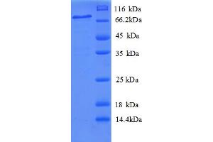 SDS-PAGE (SDS) image for Phospholipid Transfer Protein (PLTP) (AA 18-493) protein (GST tag) (ABIN5710119) (PLTP Protein (AA 18-493) (GST tag))