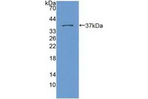 Detection of Recombinant Nesp2, Human using Polyclonal Antibody to Nesprin 2 (Nesp2) (SYNE2 Antikörper  (AA 6-296))
