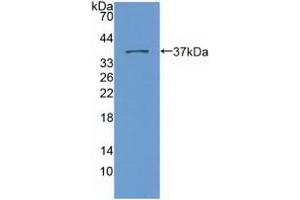 Detection of Recombinant Nesp2, Human using Polyclonal Antibody to Nesprin 2 (Nesp2)
