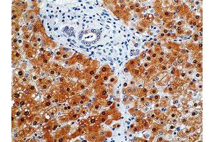 Formalin-fixed and paraffin-embedded human liver tissue (4 um) stained with NOS2 monoclonal antibody, clone K13-A  shows strong positive immunostaining of hepatocytes.