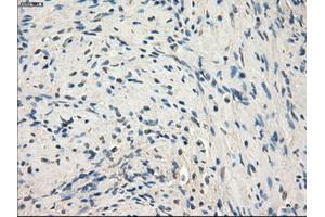 Immunohistochemical staining of paraffin-embedded endometrium tissue using anti-MAP2K1 mouse monoclonal antibody. (MEK1 Antikörper)
