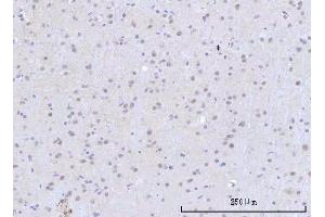 IHC analysis of RBM22 using anti-RBM22 antibody (ABIN7600268). (RBM22 Antikörper  (AA 17-406))