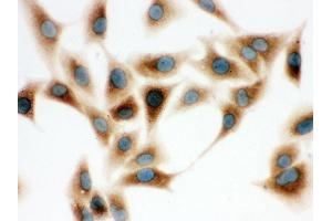 Immunohistochemistry (IHC) image for anti-Catechol-O-Methyltransferase (COMT) (AA 52-271) antibody (ABIN3043815)