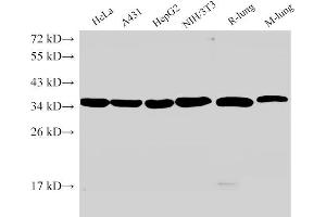 Western Blot analysis of 1)Hela, 2)A431, 3)HepG2, 4)NIH/3T3, 5)Rat lung, 6)Mouse lung using ANXA5 Ployclonal Antibody at dilution of 1:2000. (Annexin V Antikörper)