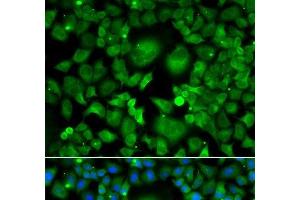 Immunofluorescence analysis of A549 cells using UBE2H Polyclonal Antibody