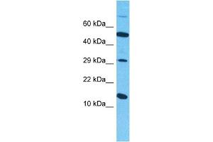 Host:  Rabbit  Target Name:  SYUB  Sample Type:  786-0 Whole Cell lysates  Antibody Dilution:  1ug/ml (beta Synuclein Antikörper  (C-Term))