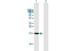 Western Blot analysis of B9D1 expression in transfected 293T cell line by B9D1 MaxPab polyclonal antibody. (B9D1 Antikörper  (AA 1-153))