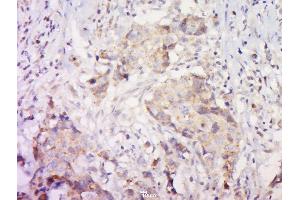 Immunohistochemistry (Paraffin-embedded Sections) (IHC (p)) image for anti-Nuclear Receptor Subfamily 1, Group I, Member 2 (NR1I2) (AA 101-150) antibody (ABIN738816)