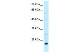 Image no. 1 for anti-TATA-Binding Protein-Associated Phosphoprotein (DR1) (AA 63-112) antibody (ABIN6747863) (DR1 Antikörper  (AA 63-112))