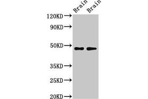 Western Blot Positive WB detected in: Rat brain tissue, Mouse brain tissue All lanes: CRHR2 antibody at 3 μg/mL Secondary Goat polyclonal to rabbit IgG at 1/50000 dilution Predicted band size: 48, 51, 47, 45, 43 kDa Observed band size: 34 kDa (CRHR2 Antikörper  (AA 20-108))