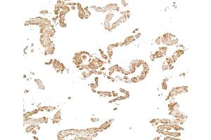 Immunocytochemistry (ICC) image for anti-Nuclear Factor-kB p65 (NFkBP65) (C-Term) antibody (ABIN7795799)