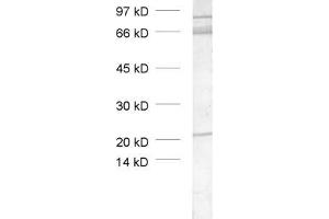 dilution: 1 : 1000, sample: crude synaptic vesicle fraction of rat brain (LP2) (TRIM9 Antikörper  (AA 1-250))
