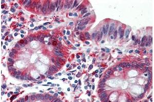 Human Colon: Formalin-Fixed, Paraffin-Embedded (FFPE) (ALDH1A1 Antikörper  (AA 1-502))