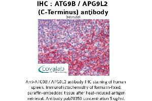 Image no. 2 for anti-Autophagy Related 9B (ATG9B) (C-Term) antibody (ABIN1732024) (ATG9B Antikörper  (C-Term))