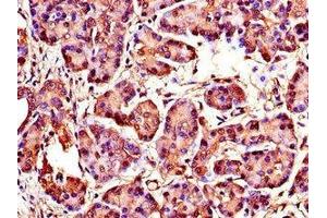 Immunohistochemistry of paraffin-embedded human pancreatic tissue using ABIN7175846 at dilution of 1:100 (WISP1 Antikörper  (AA 130-251))