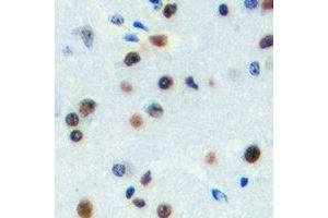 Immunohistochemical analysis of ZNF785 staining in human brain formalin fixed paraffin embedded tissue section. (ZNF785 Antikörper)