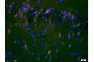 Formalin-fixed and paraffin-embedded rat brain labeled with Anti-NR2A/NMDAR2A Polyclonal Antibody, Unconjugated (ABIN747353) 1:200, overnight at 4°C, The secondary antibody was Goat Anti-Rabbit IgG, Cy3 conjugated used at 1:200 dilution for 40 minutes at 37°C. (NMDAR2A Antikörper  (AA 851-950))