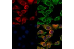 ABIN6264567 and ABIN6276965 staining Hela cells by IF/ICC. (RAB27A Antikörper  (C-Term))