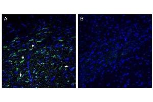 Expression of ZnT10 in rat basal ganglia. (SLC30A10 Antikörper  (C-Term, Intracellular))