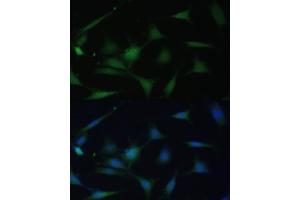 Immunofluorescence analysis of NIH-3T3 cells using p38 MAPK antibody (ABIN7268616) at dilution of 1:100. (MAPK14 Antikörper  (C-Term))