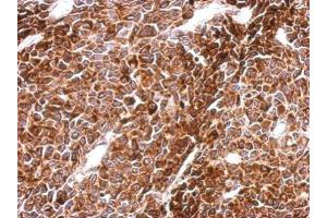 IHC-P Image Immunohistochemical analysis of paraffin-embedded BT483 xenograft, using PHF16, antibody at 1:500 dilution. (PHF16 Antikörper  (C-Term))