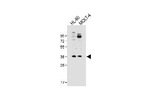 All lanes : Anti-RQCD1 Antibody (Center) at 1:500 dilution Lane 1: HL-60 whole cell lysate Lane 2: MOLT-4 whole cell lysate Lysates/proteins at 20 μg per lane. (RQCD1 Antikörper  (AA 106-134))
