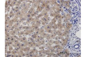 Immunoperoxidase of monoclonal antibody to CBS on formalin-fixed paraffin-embedded human liver.