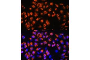 Immunofluorescence analysis of HeLa cells using AGRN Rabbit pAb (ABIN7265516) at dilution of 1:100. (AGRN Antikörper  (AA 30-350))