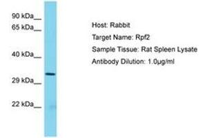 Image no. 1 for anti-Ribosome Production Factor 2 Homolog (RPF2) (AA 77-126) antibody (ABIN6750445) (RPF2 Antikörper  (AA 77-126))