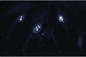 Immunofluorescence staining of human fibroblasts. (CDK4 Antikörper  (AA 1-303))