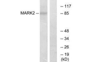 Western blot analysis of extracts from COS-7 cells, using MARK2 antibody. (MARK2 Antikörper  (N-Term))