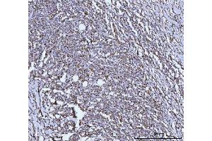 IHC analysis of GLUD1/2 using anti-GLUD1/2 antibody (ABIN7602000). (GLUD1 / GLUD2 (AA 54-553) Antikörper)