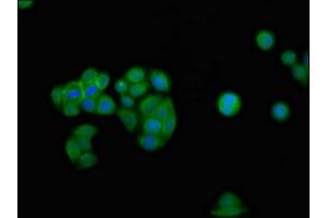 Immunofluorescence (IF) image for anti-Interferon gamma Receptor 2 (Interferon gamma Transducer 1) (IFNGR2) (AA 28-205) antibody (ABIN7156602)