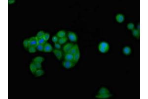 Immunofluorescence staining of PC-3 cells with ABIN7156602 at 1:100, counter-stained with DAPI. (IFNGR2 Antikörper  (AA 28-205))