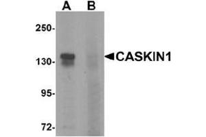 Western blot analysis of CASKIN1 in HeLa cell lysate with CASKIN1 Antibody  at 1 μg/ml in (A) the absence and (B) the presence of blocking peptide. (CASKIN1 Antikörper  (Middle Region))