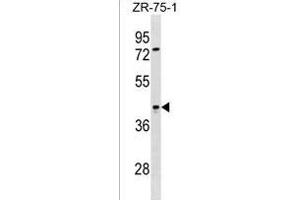 SIRPB2 Antibody (C-term) (ABIN1536893 and ABIN2838213) western blot analysis in ZR-75-1 cell line lysates (35 μg/lane). (SIRPb2 Antikörper  (C-Term))