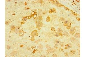 Immunohistochemistry of paraffin-embedded human placenta tissue using ABIN7165176 at dilution of 1:100 (CNPY4 Antikörper  (AA 22-248))