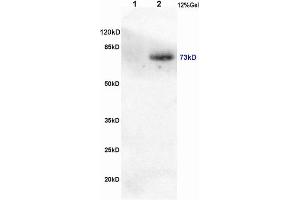 L1 rat brain, L2 human colon carcinoma lysates probed (ABIN746558) at 1:200 in 4 °C. (CRTC1 Antikörper  (pSer151))
