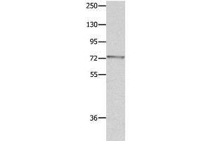 Western Blot analysis of Mouse eye tissue using MUC20 Polyclonal Antibody at dilution of 1:1400