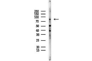 anti-KRIT1, Ankyrin Repeat Containing (KRIT1) antibody